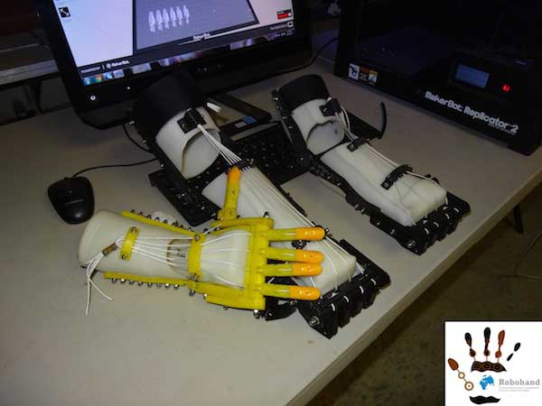 Robohand - Prothese aus dem 3D Drucker